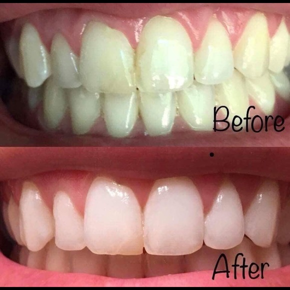 Toothpaste - Picture 5 of 6